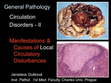 General Pathology Circulation Disorders - II Manifestations & Causes of Local Circulatory Disturbances Jaroslava Dušková Inst. Pathol.,1st Med. Faculty,