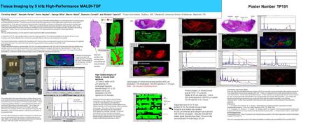 Tissue Imaging by 5 kHz High-Performance MALDI-TOF Poster Number TP191 Christina Vestal 1, Kenneth Parker 1, Kevin Hayden 1, George Mills 1, Marvin Vestal.