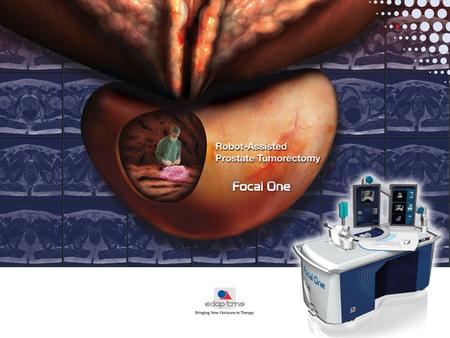 Product Presentation B ASES OF F OCAL T HERAPY Focal Therapy Rationale Focal therapy represents the perfect balance between Active Surveillance and.