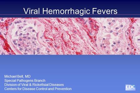 Viral Hemorrhagic Fevers Michael Bell, MD Special Pathogens Branch Division of Viral & Rickettsial Diseases Centers for Disease Control and Prevention.