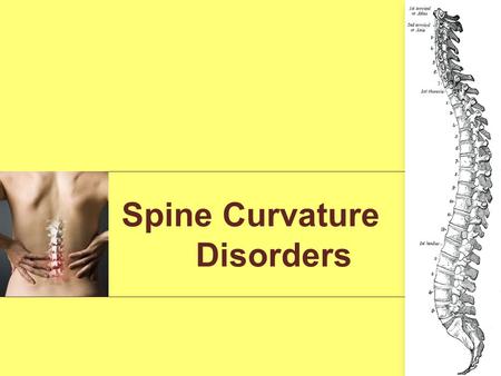 Spine Curvature Disorders