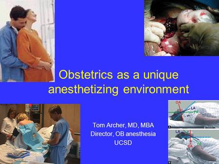 Obstetrics as a unique anesthetizing environment Tom Archer, MD, MBA Director, OB anesthesia UCSD.