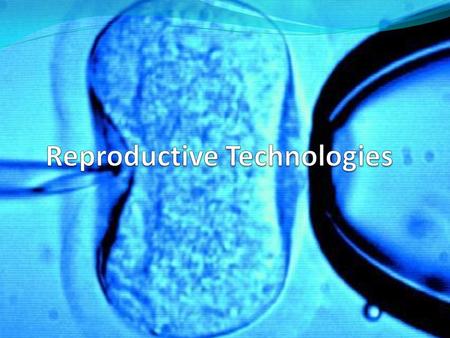 Diagnostic Techniques Amniocentesis- Performed during high- risk pregnancies (those at risk for birth defects) Using ultrasound as a guide, a small, thin.