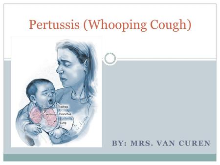 BY: MRS. VAN CUREN Pertussis (Whooping Cough). What is Whooping Cough? Whooping cough is an extremely contagious upper respiratory infection. It causes.