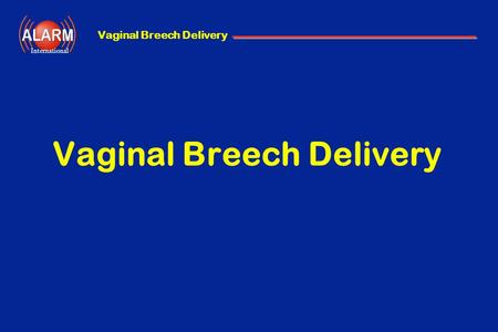 Vaginal Breech Delivery