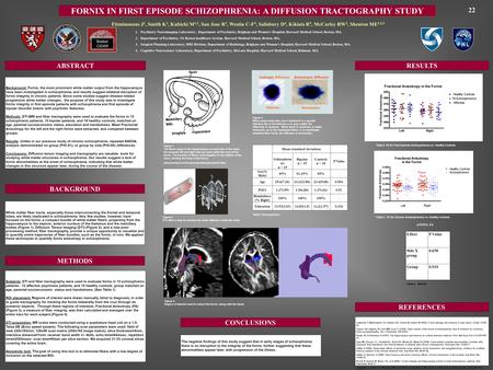 FORNIX IN FIRST EPISODE SCHIZOPHRENIA: A DIFFUSION TRACTOGRAPHY STUDY Background: Fornix, the most prominent white matter output from the hippocampus have.