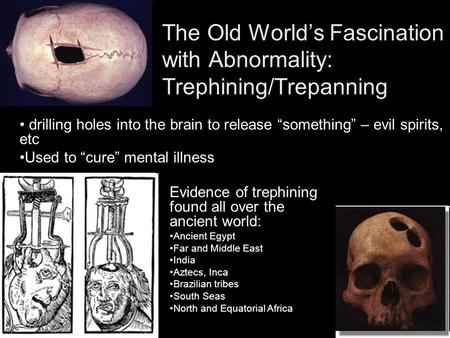 The Old World’s Fascination with Abnormality: Trephining/Trepanning