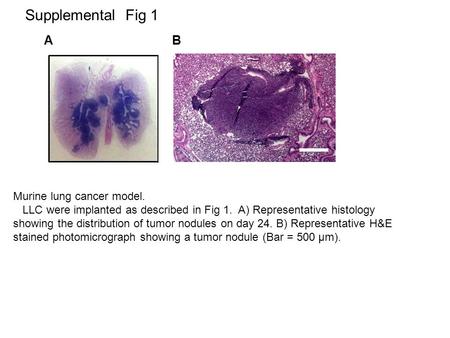 Supplemental Fig 1 Rt. Lung Tumor A B Murine lung cancer model. LLC were implanted as described in Fig 1. A) Representative histology showing the distribution.