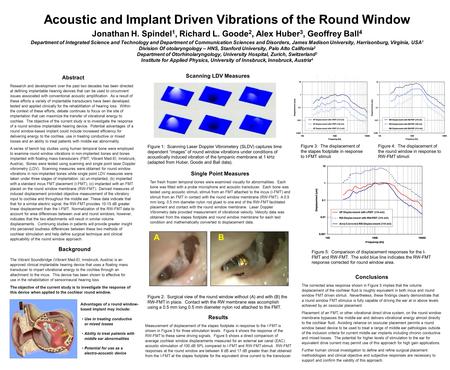 Acoustic and Implant Driven Vibrations of the Round Window Jonathan H. Spindel 1, Richard L. Goode 2, Alex Huber 3, Geoffrey Ball 4 Department of Integrated.