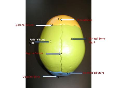 1 Frontal bone Coronal Suture 4 2 Parietal Bone Right Parietal Bone