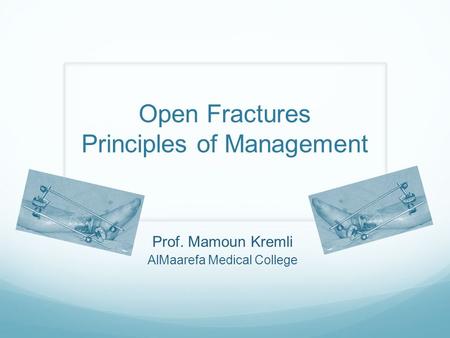 Prof. Mamoun Kremli AlMaarefa Medical College Open Fractures Principles of Management.