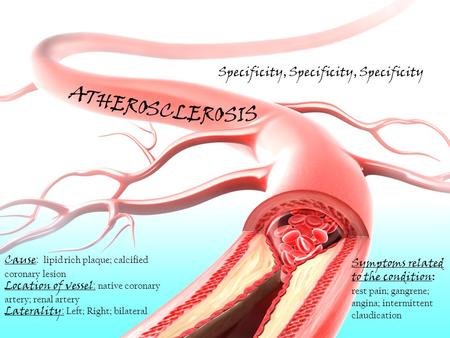 Cause : lipid rich plaque; calcified coronary lesion Location of vessel : native coronary artery; renal artery Laterality : Left; Right; bilateral Specificity,