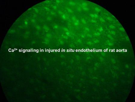 Ca 2+ signaling in injured in situ endothelium of rat aorta.