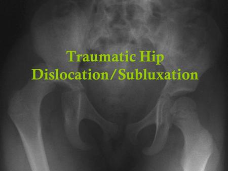 Traumatic Hip Dislocation/Subluxation. When the femur moves out of its normal position in the socket Two general categories of hip dislocations exist,