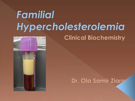  is a genetic disorder characterized by high cholesterol levels.  specifically very high levels of low-density lipoprotein in the blood and early cardiovascular.