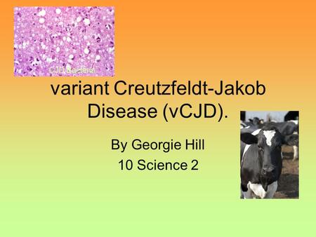 Variant Creutzfeldt-Jakob Disease (vCJD). By Georgie Hill 10 Science 2 CJD Bacteria.