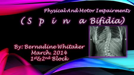 WHAT IS SPINA BIFIDA? WHAT IS SPINA BIFIDA? WW Spina bifida is a “birth defect that means split or open spine. It occurs when the bones of the spine.