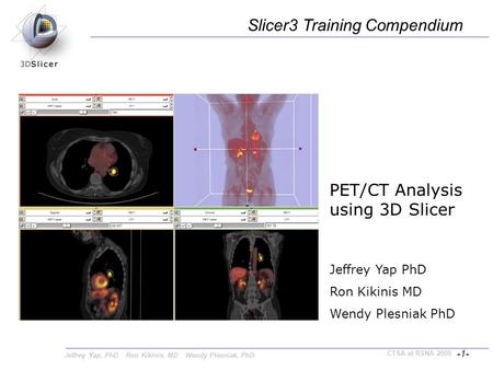 Jeffrey Yap, PhD Ron Kikinis, MD Wendy Plesniak, PhD -1- CTSA at RSNA 2009 PET/CT Analysis using 3D Slicer Jeffrey Yap PhD Ron Kikinis MD Wendy Plesniak.