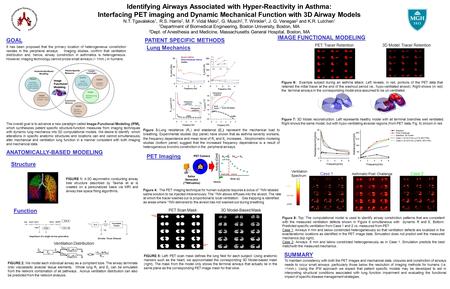 Identifying Airways Associated with Hyper-Reactivity in Asthma: Interfacing PET imaging and Dynamic Mechanical Function with 3D Airway Models N.T. Tgavalekos.