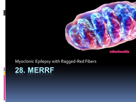 Myoclonic Epilepsy with Ragged-Red Fibers