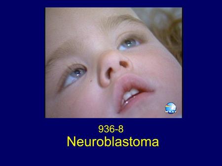 Neuroblastoma 936-8. Case Records Of the Massachusetts General Hospital Case 27-1995 New England Journal of Medicine 1995;333:579-586.