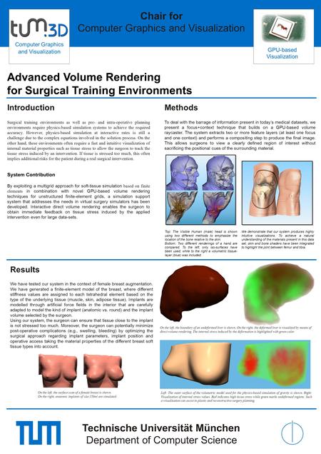 Introduction Surgical training environments as well as pre- and intra-operative planning environments require physics-based simulation systems to achieve.