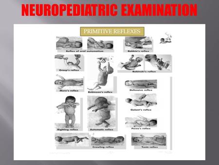 NEUROPEDIATRIC EXAMINATION