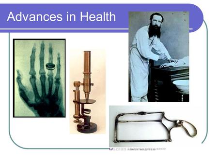 Advances in Health. Public Health The 1875 Public Health act forced local Authorities to provide adequate sewerage, drainage and water. Infectious diseases.