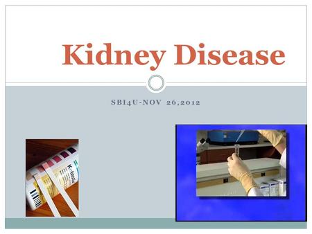 SBI4U-NOV 26,2012 Kidney Disease. Diabetes Insipidus (DI) Destruction of ADH-producing cells of the hypothalamus or destruction of hypothalamus- pituitary.