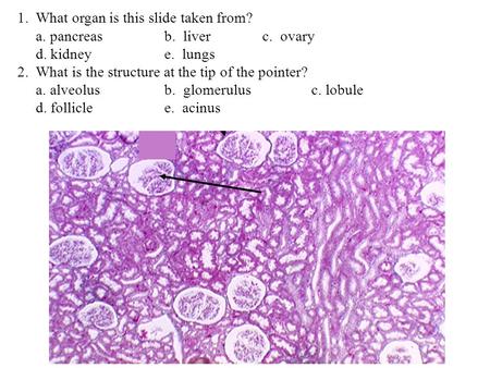 What organ is this slide taken from?