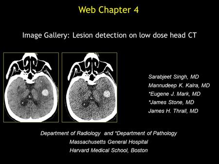 Image Gallery: Lesion detection on low dose head CT Sarabjeet Singh, MD Mannudeep K. Kalra, MD *Eugene J. Mark, MD *James Stone, MD James H. Thrall, MD.