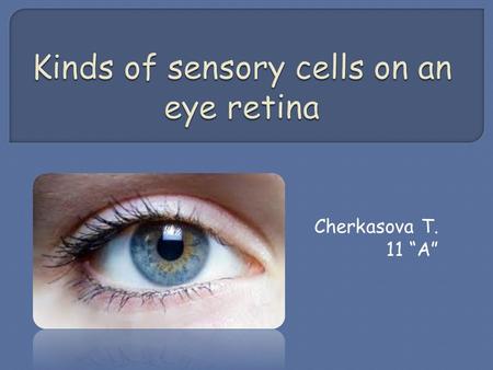 Cherkasova T. 11 “A”. The retina of the eye contains two kinds of sensory cells: cones and rods 1. Are both kinds of cells spread evenly across the retina.