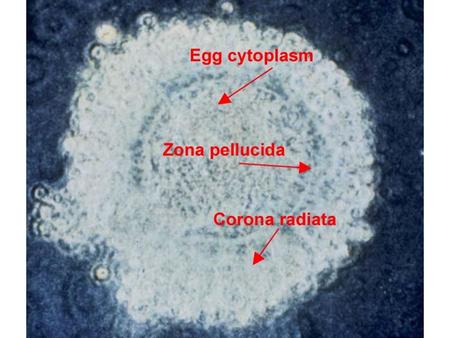 FERTILIZATION 01 HUMAN OVUM:  Identify the CORONA RADIATA, ZONA PELLUCIDA AND EGG CYTOPLASM