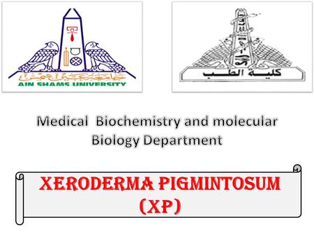 Xeroderma Pigmintosum (XP). Group Leader : 93-Esraa Samy Faried Abdelghafar. Members : 91-Esraa Raafat Ahmed Ahmed. 92-Esraa Reda Hashem Tewfik. 94-Esraa.