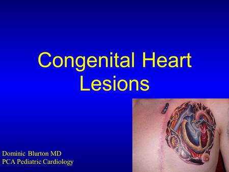 Congenital Heart Lesions