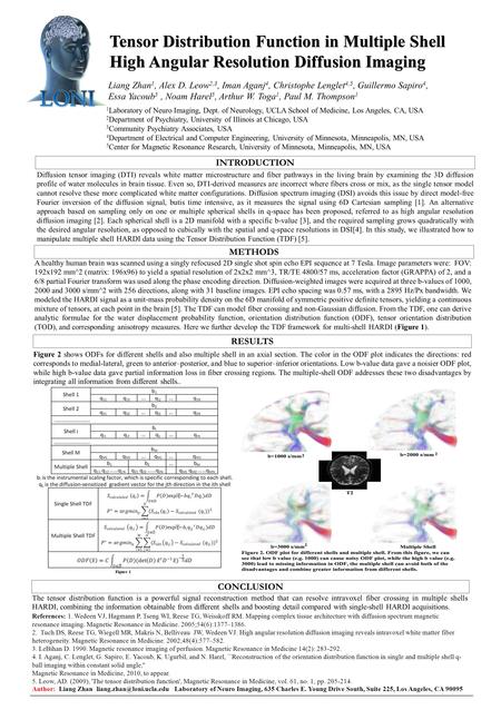 Tensor Distribution Function in Multiple Shell High Angular Resolution Diffusion Imaging Tensor Distribution Function in Multiple Shell High Angular Resolution.