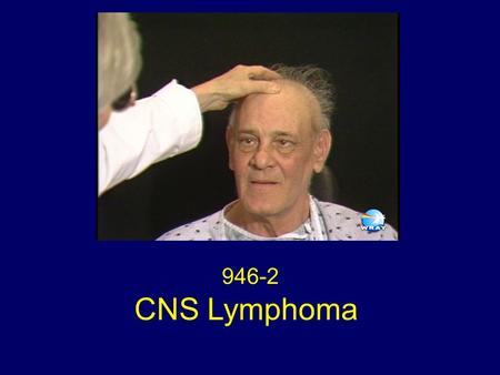 CNS Lymphoma 946-2. Neuroimaging Figure 1: Sagittal T1WI shows infiltration of the clivus, sphenoid sinus, upper cervical spine and pituitary gland with.