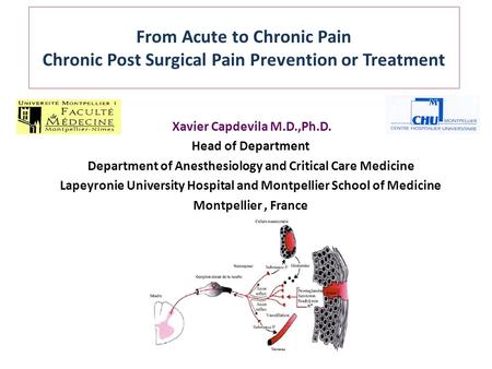 From Acute to Chronic Pain Chronic Post Surgical Pain Prevention or Treatment Xavier Capdevila M.D.,Ph.D. Head of Department Department of Anesthesiology.