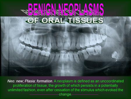 BENIGN NEOPLASMS OF ORAL TISSUES