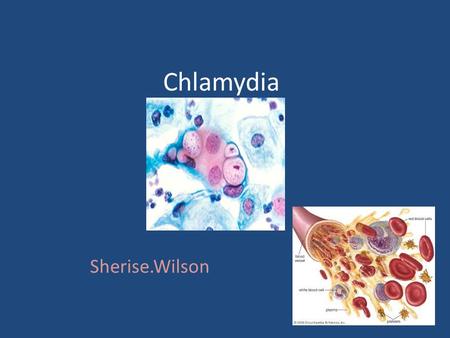 Chlamydia Sherise.Wilson. Chlamydia Most Commonly Caught Due To The Fact That There Is No Symptoms Most Times Sexually Transmitted if it's not treated.