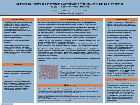 POSTER TEMPLATE BY: www.PosterPresentations.com Spontaneous rupture of a pyometra in a woman with a mixed mullerian tumour of the uterine corpus - A review.