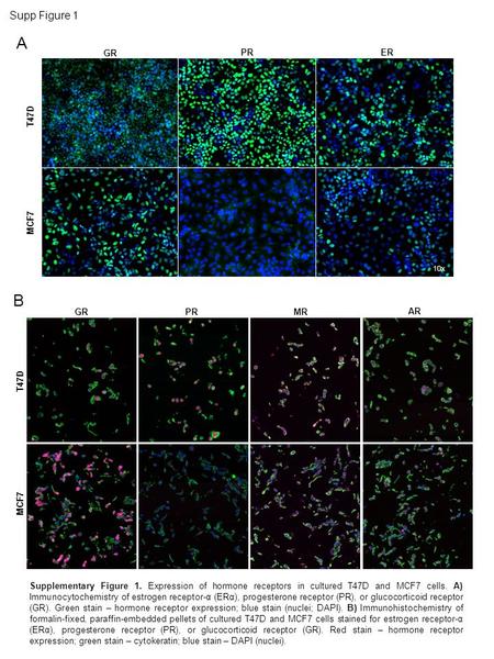 Supplementary Figure 1. Expression of hormone receptors in cultured T47D and MCF7 cells. A) Immunocytochemistry of estrogen receptor-α (ERα), progesterone.