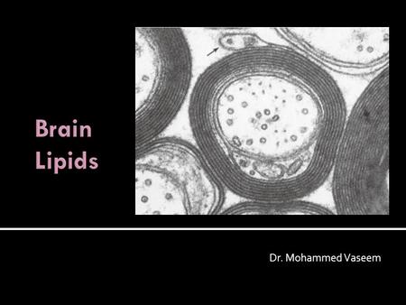 Dr. Mohammed Vaseem. Simple Lipids Compound Lipids Derived Lipids LIPIDS.