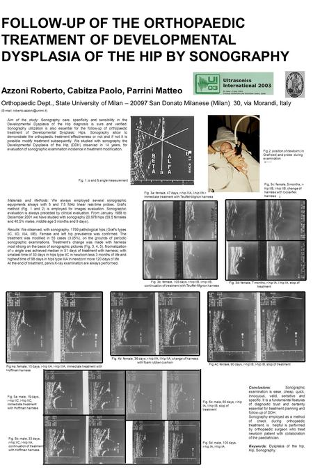 FOLLOW-UP OF THE ORTHOPAEDIC TREATMENT OF DEVELOPMENTAL DYSPLASIA OF THE HIP BY SONOGRAPHY Azzoni Roberto, Cabitza Paolo, Parrini Matteo Orthopaedic Dept.,