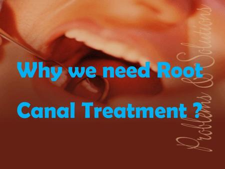 Why we need Root Canal Treatment ?