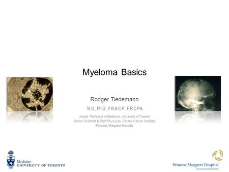 Myeloma Basics Rodger Tiedemann M.D., Ph.D., F.R.A.C.P., F.R.C.P.A. Assist. Professor of Medicine, University of Toronto Senior Scientist & Staff Physician,