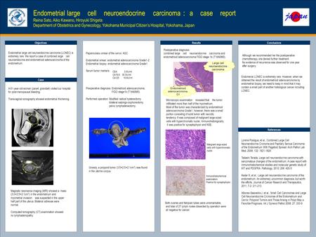 TEMPLATE DESIGN © 2008 www.PosterPresentations.com Endometrial large cell neuroendocrine carcinoma ： a case report Reina Sato, Aiko Kawano, Hiroyuki Shigeta.