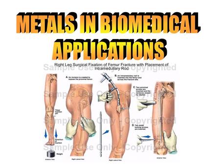 Material engineering VS. Bioengineering In the beginning, material application was a problem of material choice. These days, scientists can device their.