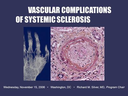 Wednesday, November 15, 2006 Washington, DC Richard M. Silver, MD, Program Chair VASCULAR COMPLICATIONS OF SYSTEMIC SCLEROSIS.