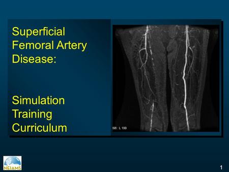 Superficial Femoral Artery Disease: